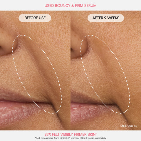 Bouncy Skin On The Go