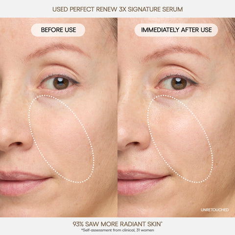 Perfect Renew 3X Signature Serum